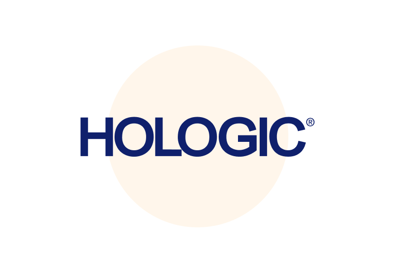 Hologic case study